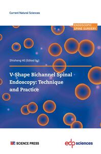 V-shape Bichannel Spinal Endoscopy:  Technique and Practice