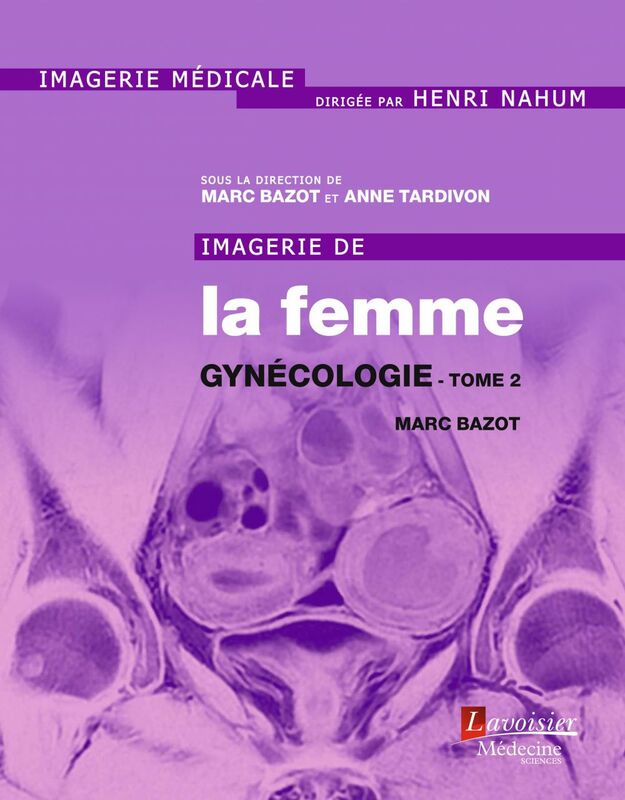 Imagerie de la femme Volume 3 Gynécologie Volume 2