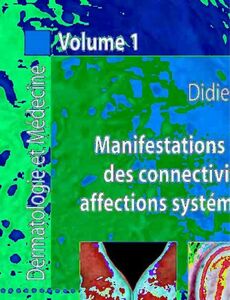 Dermatologie et médecine Volume 1, Manifestations dermatologiques des connectivites, vasculites et affections systémiques apparentées