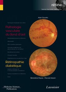 Rétine Volume 3, Pathologie vasculaire du fond d'oeil, rétinopathie diabétique