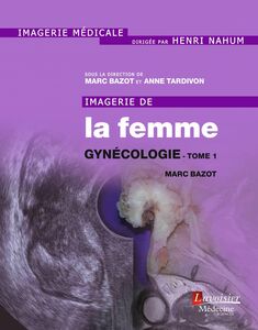 Imagerie de la femme Volume 2 Gynécologie Volume 1