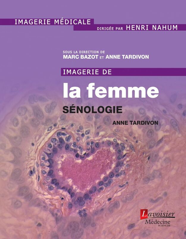 Imagerie de la femme Volume 1, Sénologie
