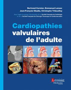 Cardiopathies valvulaires de l'adulte