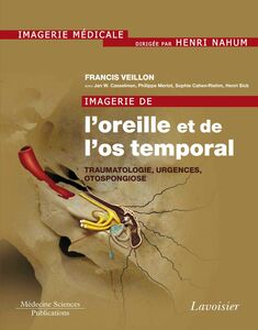 Imagerie de l'oreille et de l'os temporal Volume 3, Traumatologie, urgences, otospongiose