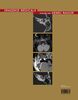 Imagerie de l'oreille et de l'os temporal Volume 3, Traumatologie, urgences, otospongiose