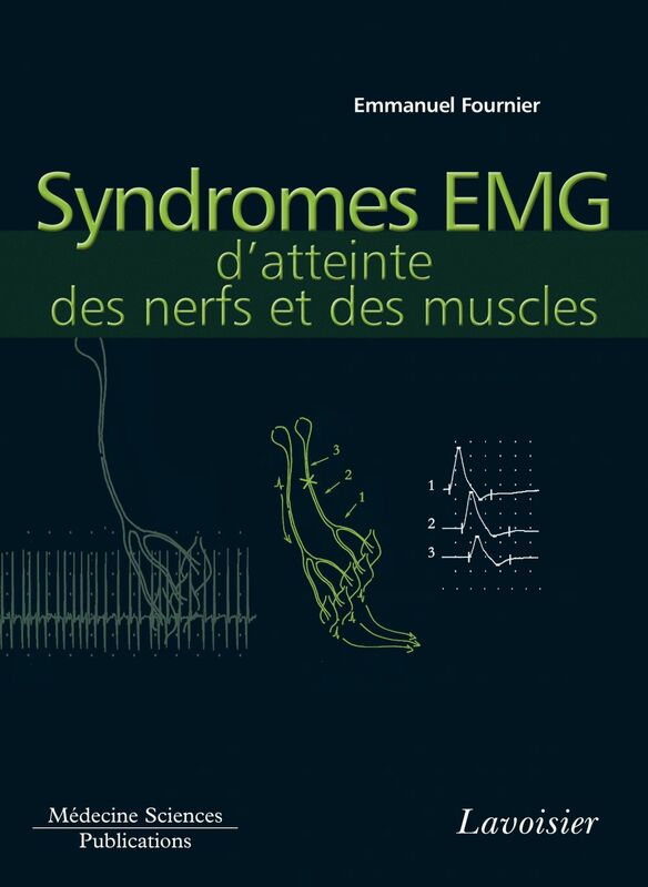 Electromyographie Volume 4, Syndromes EMG d'atteinte des nerfs et des muscles