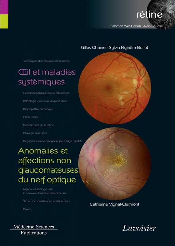 Rétine Volume 5, Oeil et maladies systémiques Anomalies et affections non glaucomateuses du nerf optique