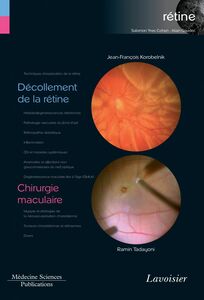 Rétine Volume 6, Décollement de la rétine Chirurgie maculaire