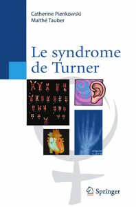 Le syndrome de Turner