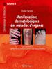 Dermatologie et médecine Volume 4, Manifestations dermatologiques des maladies d'organes
