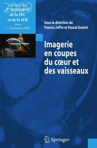 Imagerie en coupes du coeur et des vaisseaux : compte-rendu des 3es rencontres de la SFC et de la SFR : Paris, 5 et 6 novembre 2009
