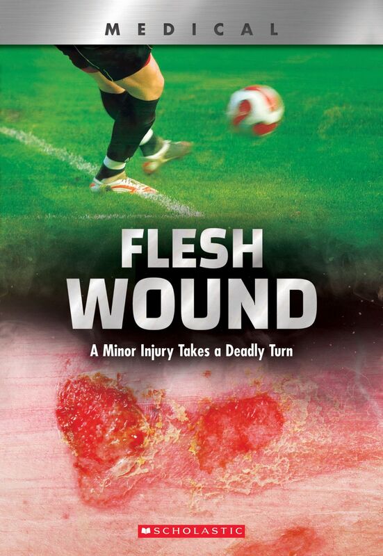 Flesh Wound: A Minor Injury Takes a Deadly Turn (XBooks) A Minor Injury Takes a Deadly Turn