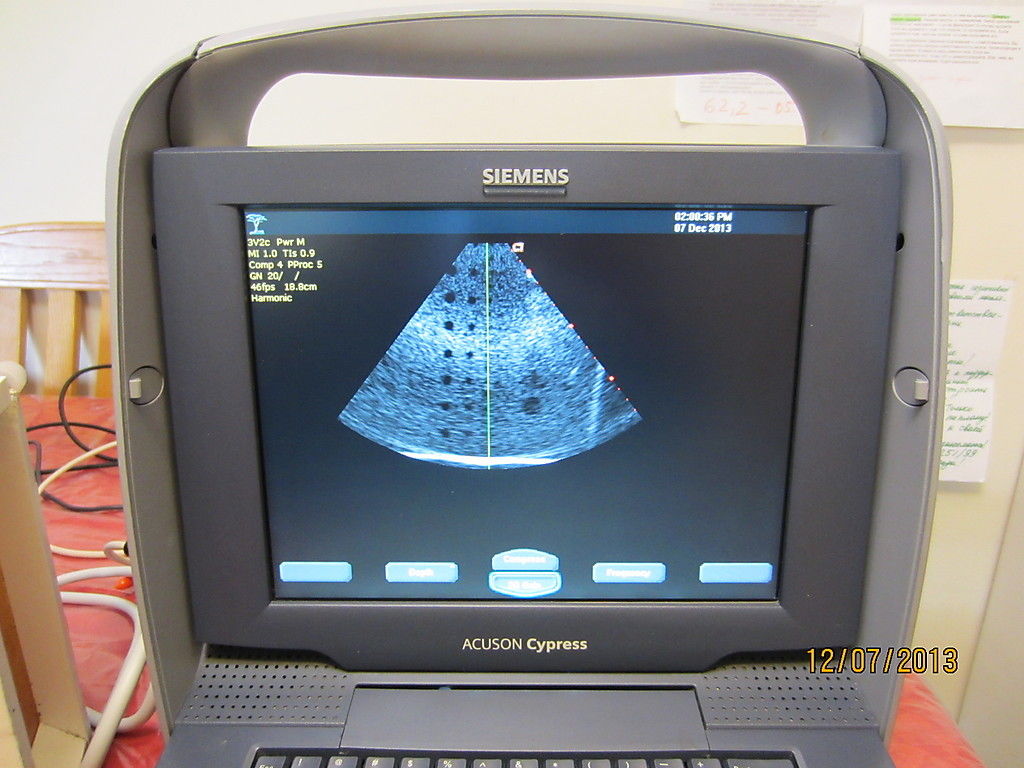 Photo 2013 Siemens Acuson Cypress Ultrasound Machine