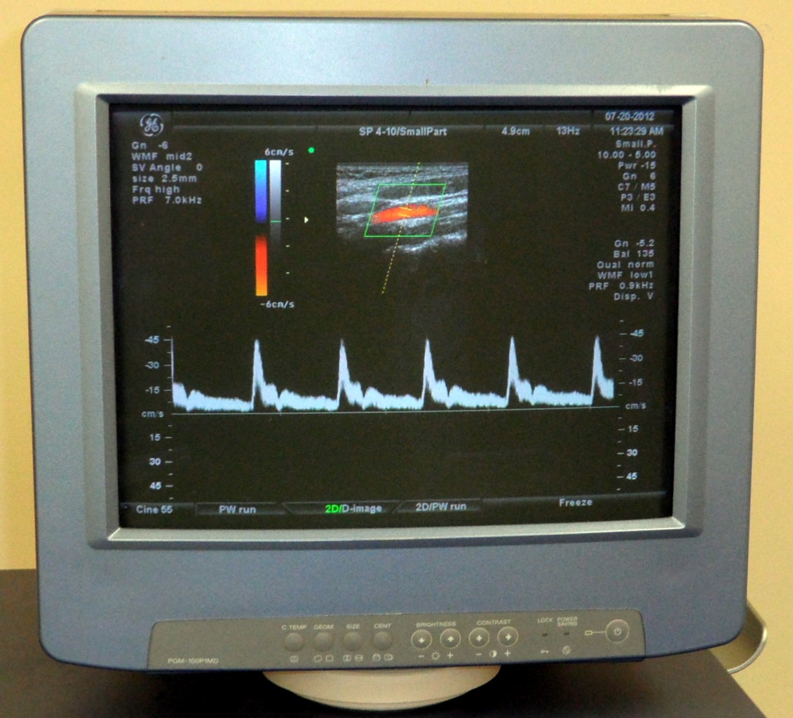 Kretz Voluson 730 Expert 3D/4D OB/GYN & Vascular Ultrasound machine ...